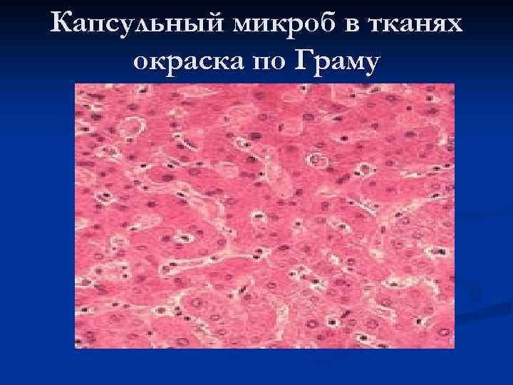 Клетка метод окраски. Методы окраски микробной клетки. Окрашивание по Романовскому - Гимзе. Окраска структур бактерий. ВАНГИЗОН метод окраски.