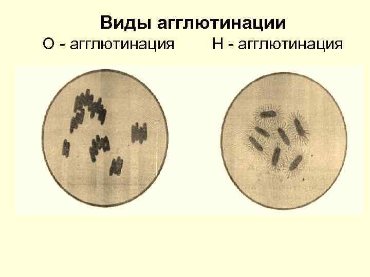 Виды агглютинации О - агглютинация Н - агглютинация 
