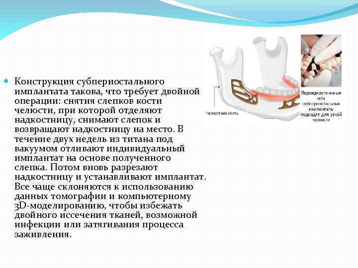  Конструкция субпериостального имплантата такова, что требует двойной операции: снятия слепков кости челюсти, при