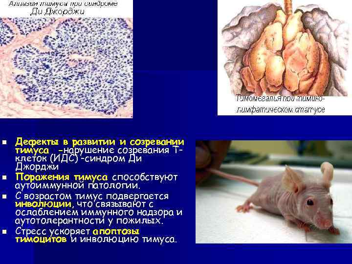 n n Дефекты в развитии и созревании тимуса -нарушение созревания Тклеток (ИДС) -синдром Ди