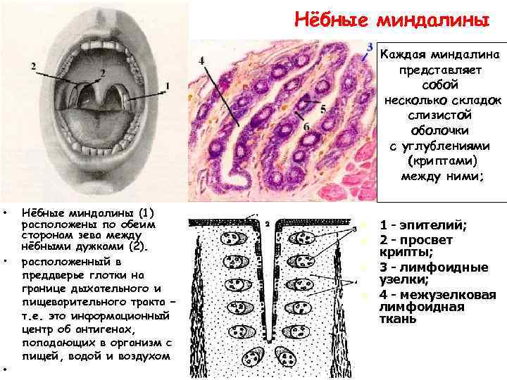 Нёбные миндалины Каждая миндалина представляет собой несколько складок слизистой оболочки с углублениями (криптами) между