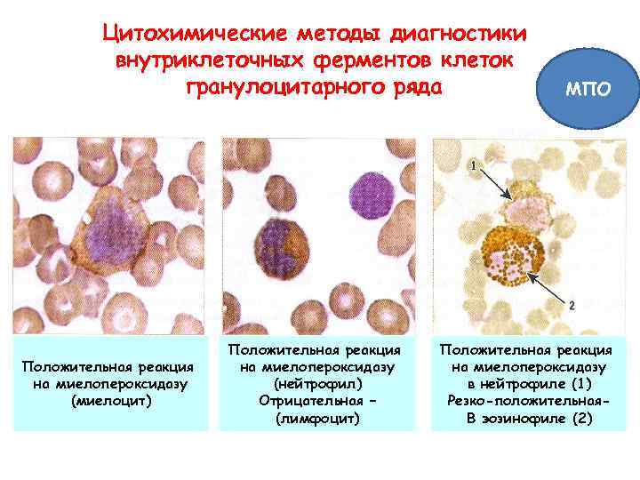 Цитохимические методы диагностики внутриклеточных ферментов клеток гранулоцитарного ряда Положительная реакция на миелопероксидазу (миелоцит) Положительная