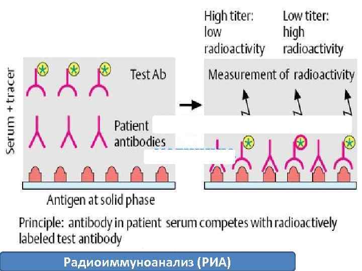 Радиоиммуноанализ (РИА) 