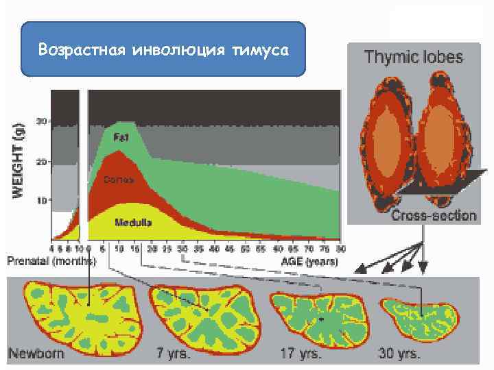 Возрастная инволюция тимуса 