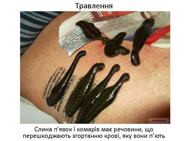 Травлення Слина п’явок і комарів має речовини, що перешкоджають згортанню крові, яку вони п’ють