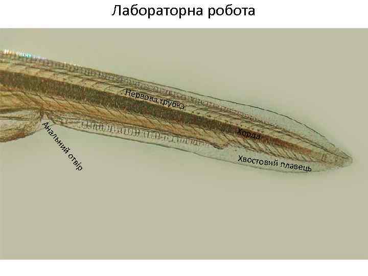 Лабораторна робота Нерв ова т рубка а Ан ір тв йо ни ль Хорд