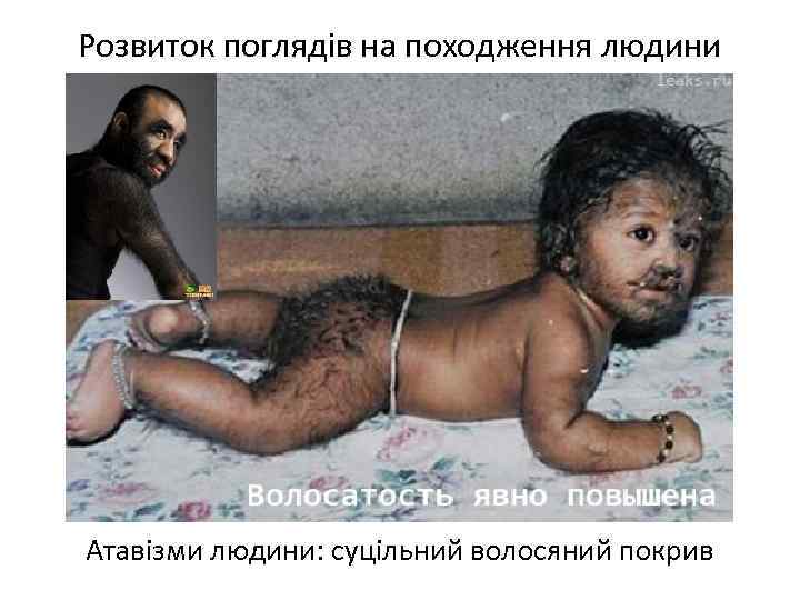 Розвиток поглядів на походження людини Атавізми людини: суцільний волосяний покрив 