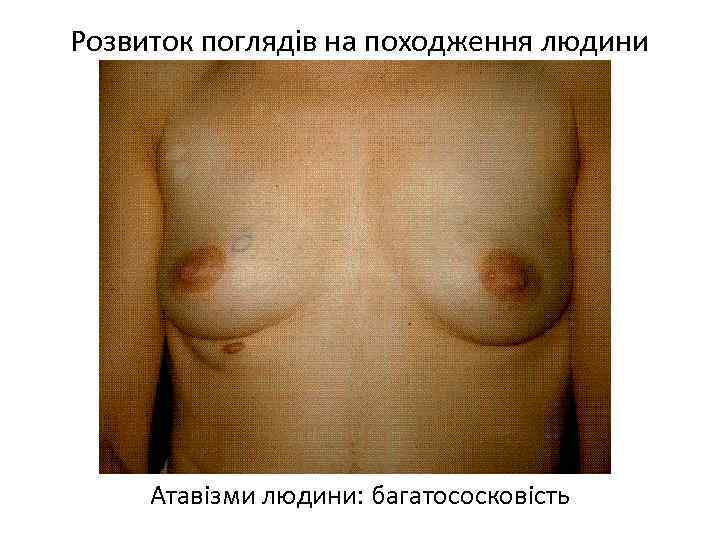 Розвиток поглядів на походження людини Атавізми людини: багатососковість 