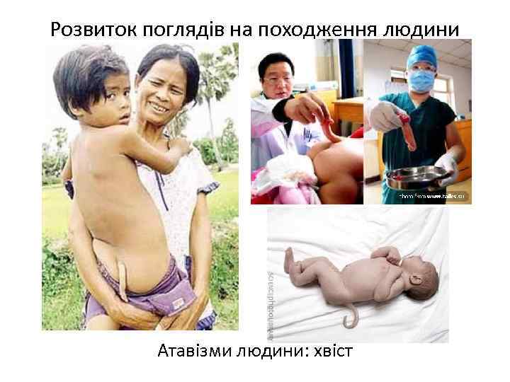 Розвиток поглядів на походження людини Атавізми людини: хвіст 