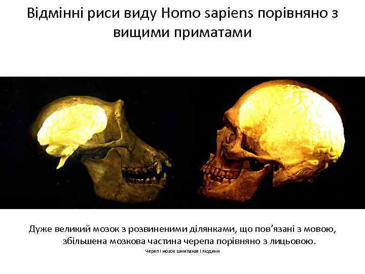 Відмінні риси виду Homo sapiens порівняно з вищими приматами Дуже великий мозок з розвиненими