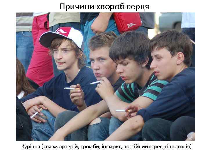 Причини хвороб серця Куріння (спазм артерій, тромби, інфаркт, постійний стрес, гіпертонія) 