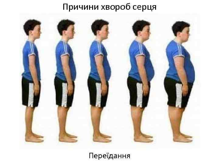 Причини хвороб серця Переїдання 