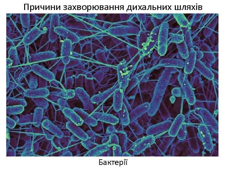 Причини захворювання дихальних шляхів Бактерії 