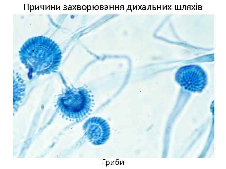 Причини захворювання дихальних шляхів Гриби 