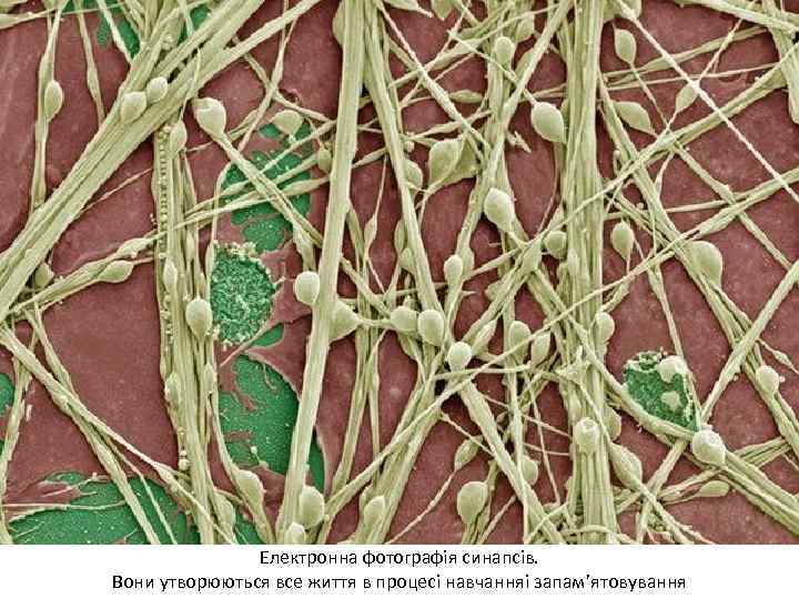 Синапс Електронна фотографія синапсів. Вони утворюються все життя в процесі навчанняі запам’ятовування 