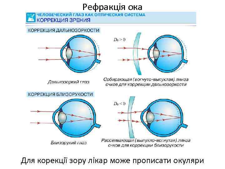 Рефракція ока Для корекції зору лікар може прописати окуляри 