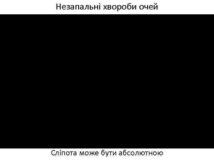 Незапальні хвороби очей Сліпота може бути абсолютною 