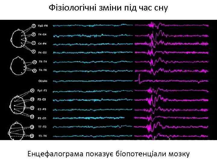 Фізіологічні зміни під час сну Енцефалограма показує біопотенціали мозку 