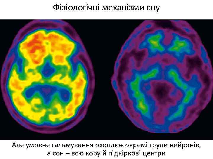 Фізіологічні механізми сну Але умовне гальмування охоплює окремі групи нейронів, а сон – всю