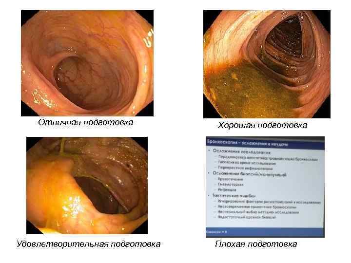 Отличная подготовка Удовлетворительная подготовка Хорошая подготовка Плохая подготовка 