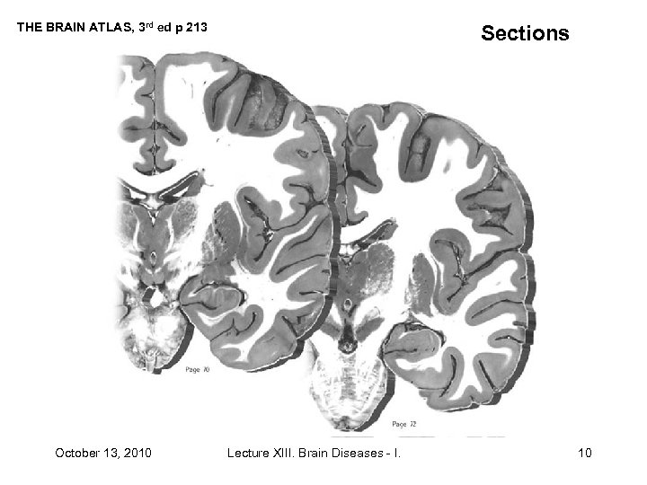 THE BRAIN ATLAS, 3 rd ed p 213 October 13, 2010 Sections Lecture XIII.