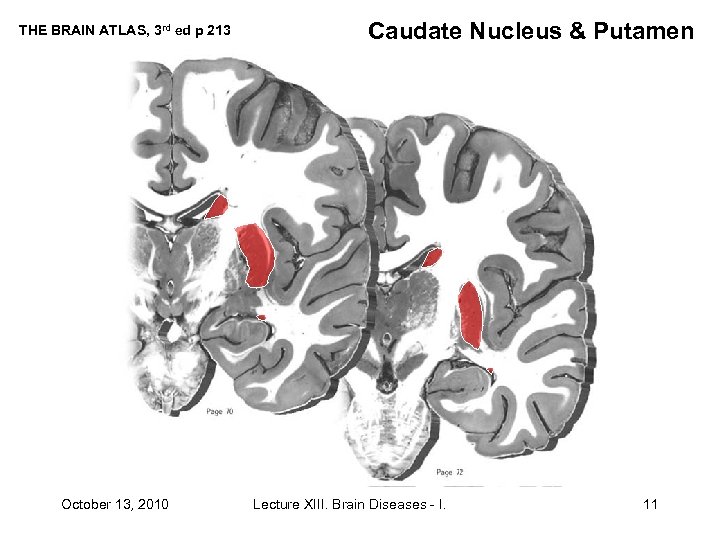 THE BRAIN ATLAS, 3 rd ed p 213 October 13, 2010 Caudate Nucleus &