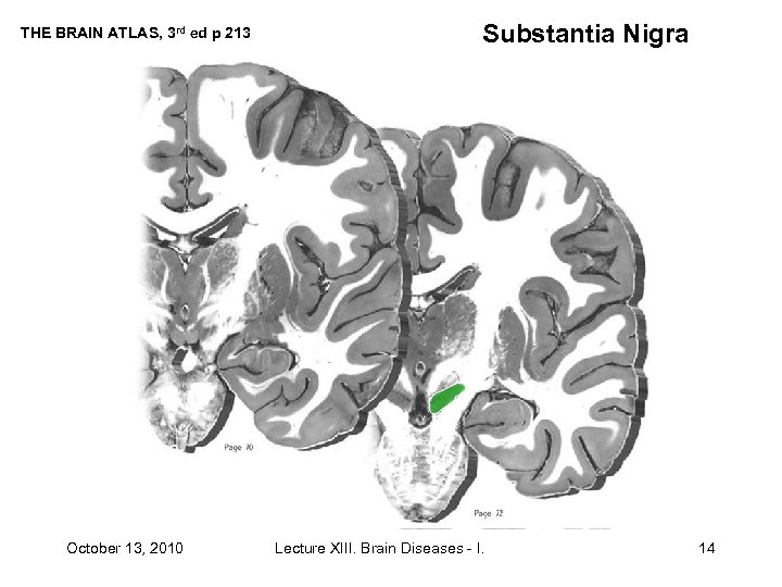 THE BRAIN ATLAS, 3 rd ed p 213 October 13, 2010 Substantia Nigra Lecture