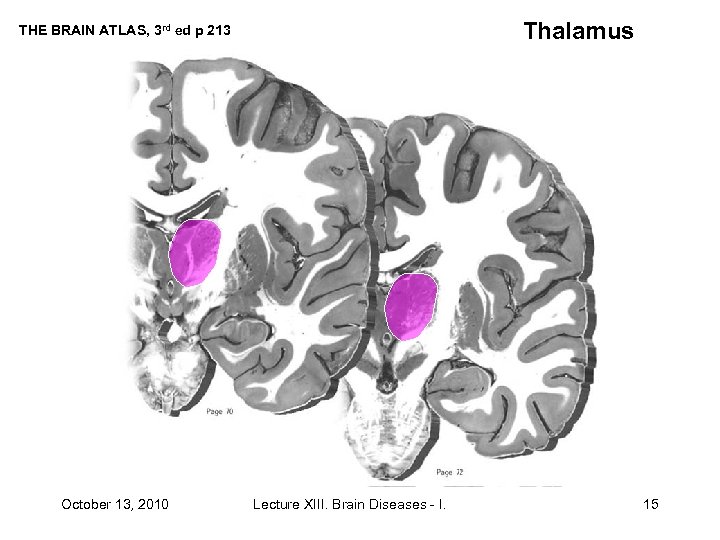 Thalamus THE BRAIN ATLAS, 3 rd ed p 213 October 13, 2010 Lecture XIII.