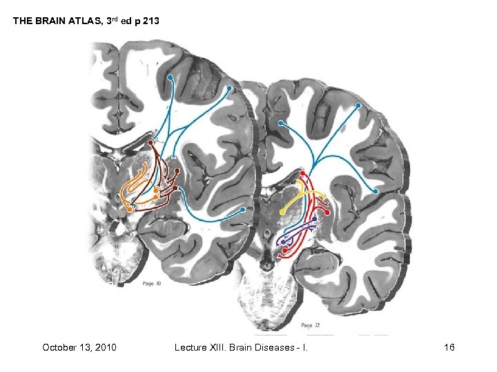 THE BRAIN ATLAS, 3 rd ed p 213 October 13, 2010 Lecture XIII. Brain