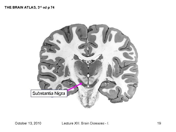 THE BRAIN ATLAS, 3 rd ed p 74 Substantia Nigra October 13, 2010 Lecture