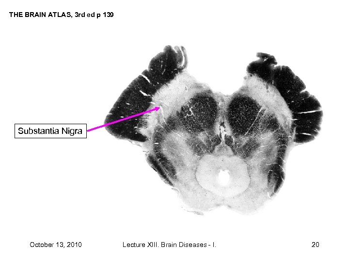 THE BRAIN ATLAS, 3 rd ed p 139 Substantia Nigra October 13, 2010 Lecture