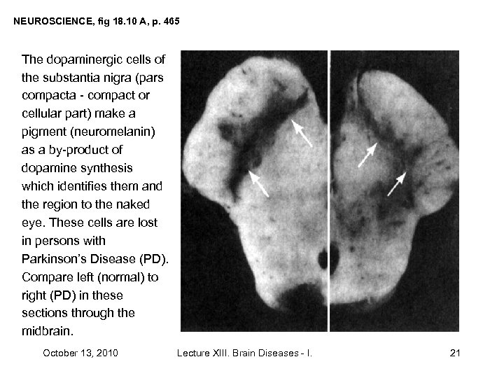 NEUROSCIENCE, fig 18. 10 A, p. 465 The dopaminergic cells of the substantia nigra