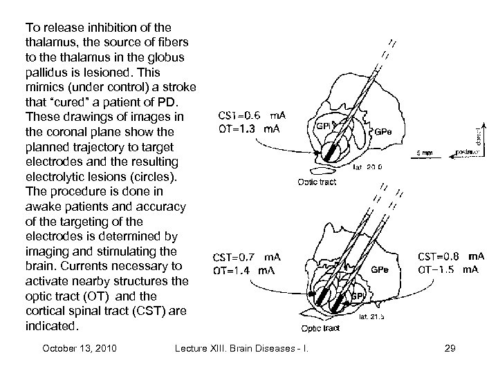 To release inhibition of the thalamus, the source of fibers to the thalamus in