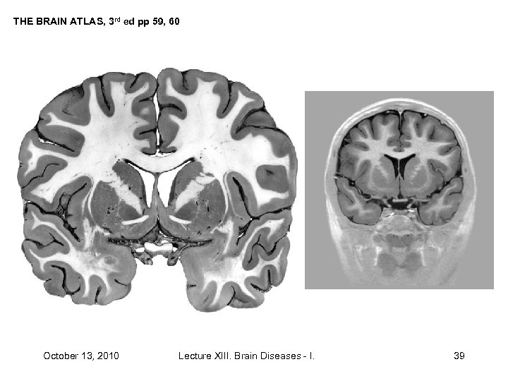 THE BRAIN ATLAS, 3 rd ed pp 59, 60 October 13, 2010 Lecture XIII.