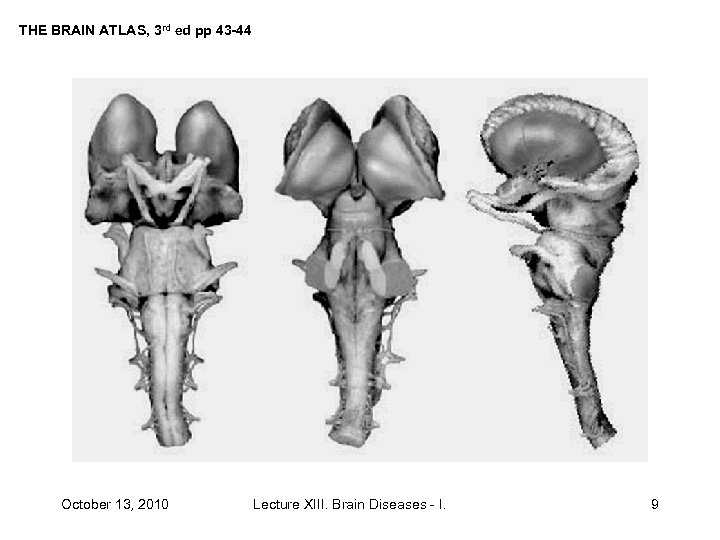 THE BRAIN ATLAS, 3 rd ed pp 43 -44 October 13, 2010 Lecture XIII.