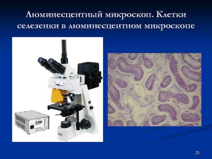 Люминесцентный микроскоп. Клетки селезенки в люминесцентном микроскопе 23 