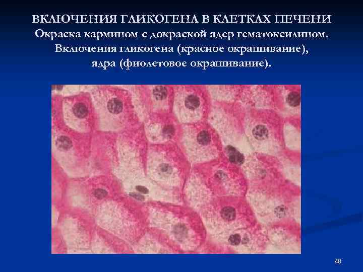 ВКЛЮЧЕНИЯ ГЛИКОГЕНА В КЛЕТКАХ ПЕЧЕНИ Окраска кармином с докраской ядер гематоксилином. Включения гликогена (красное