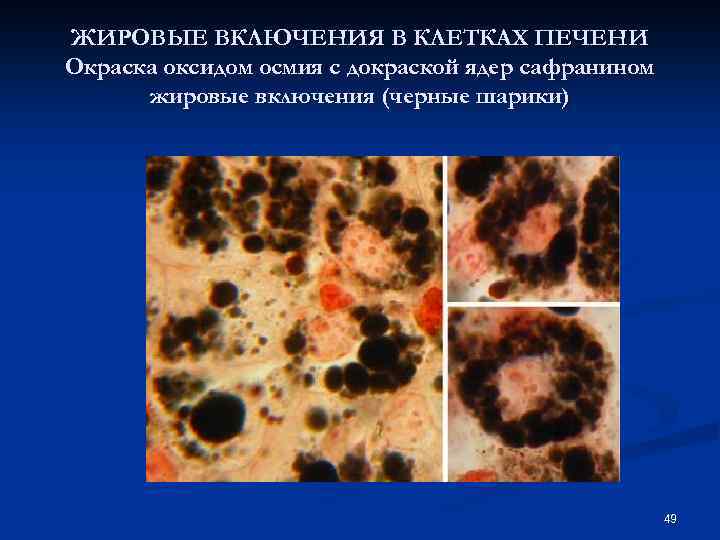 ЖИРОВЫЕ ВКЛЮЧЕНИЯ В КЛЕТКАХ ПЕЧЕНИ Окраска оксидом осмия с докраской ядер сафранином жировые включения