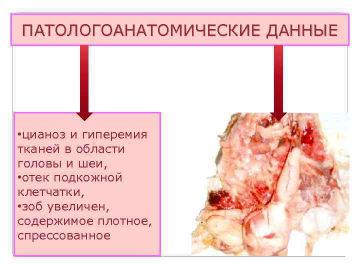 ПАТОЛОГОАНАТОМИЧЕСКИЕ ДАННЫЕ • цианоз и гиперемия тканей в области головы и шеи, • отек