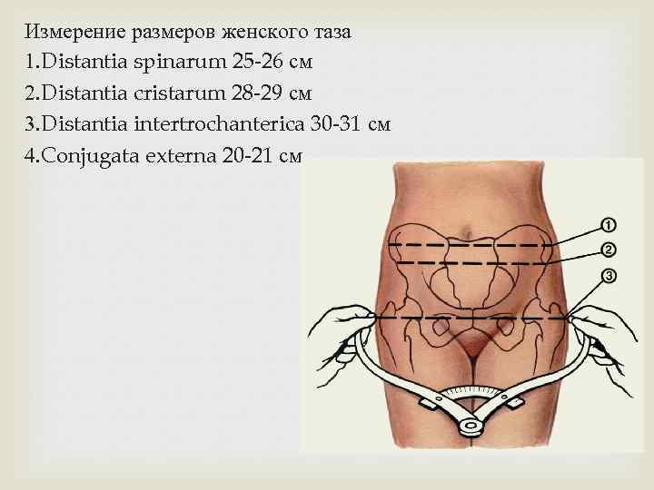 Измерение размеров женского таза 1. Distantia spinarum 25 -26 см 2. Distantia cristarum 28