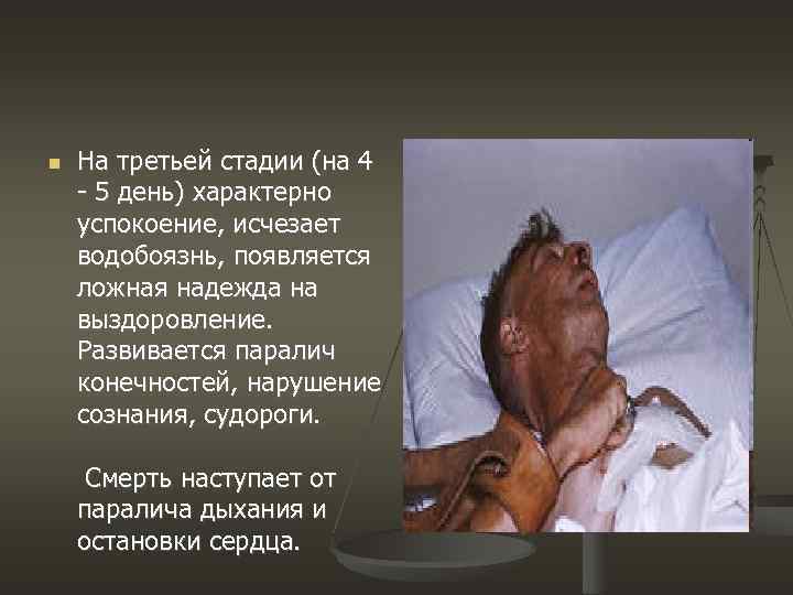  На третьей стадии (на 4 - 5 день) характерно успокоение, исчезает водобоязнь, появляется