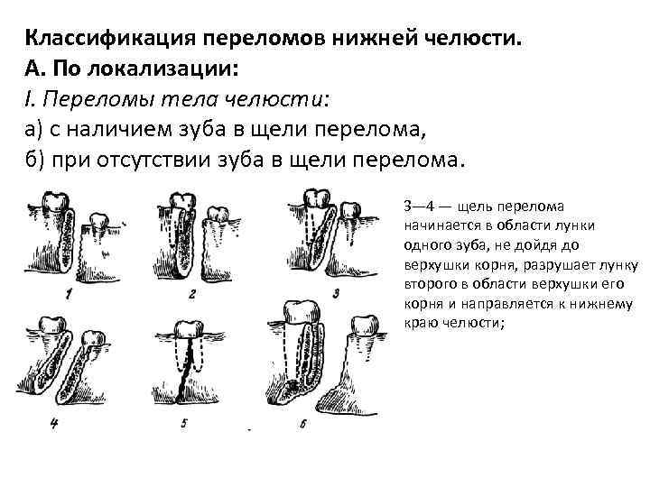 Клиническая картина при переломах нижней челюсти