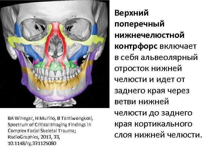 BA Winegar, H Murillo, B Tantiwongkosi, Spectrum of Critical Imaging Findings in Complex Facial