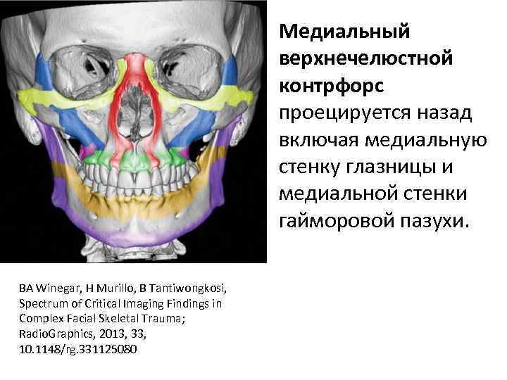 Медиальный верхнечелюстной контрфорс проецируется назад включая медиальную стенку глазницы и медиальной стенки гайморовой пазухи.