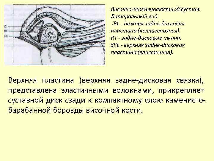 Височно-нижнечелюстной сустав. Латеральный вид. IRL - нижняя задне-дисковая пластина (коллагенозная). RT - задне-дисковые ткани.