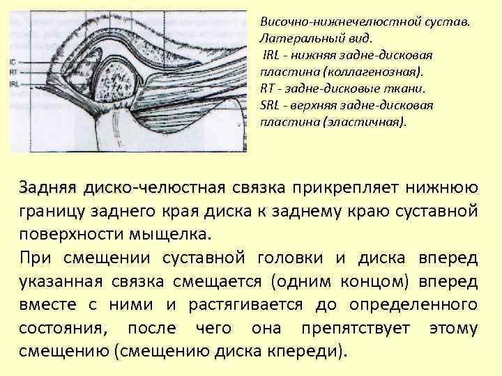 Височно-нижнечелюстной сустав. Латеральный вид. IRL - нижняя задне-дисковая пластина (коллагенозная). RT - задне-дисковые ткани.
