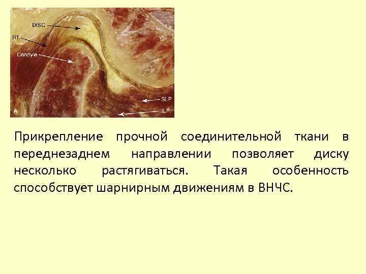 Прикрепление прочной соединительной ткани в переднезаднем направлении позволяет диску несколько растягиваться. Такая особенность способствует