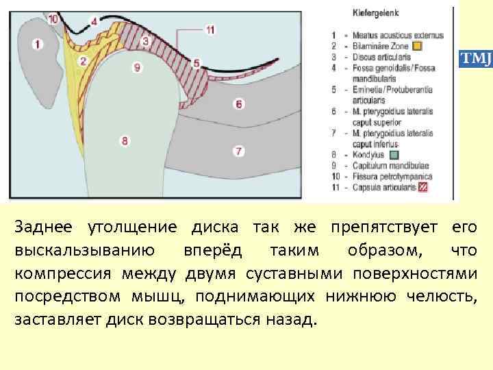 Заднее утолщение диска так же препятствует его выскальзыванию вперёд таким образом, что компрессия между