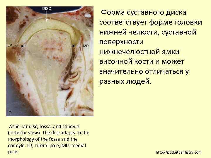  Форма суставного диска соответствует форме головки нижней челюсти, суставной поверхности нижнечелюстной ямки височной