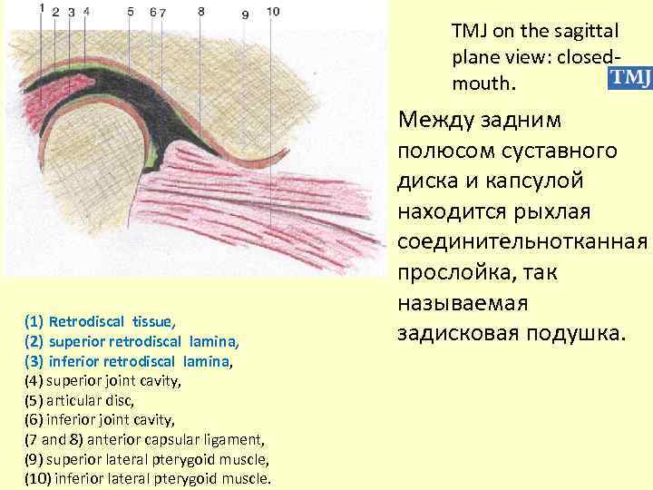 TMJ on the sagittal plane view: closedmouth. (1) Retrodiscal tissue, (2) superior retrodiscal lamina,